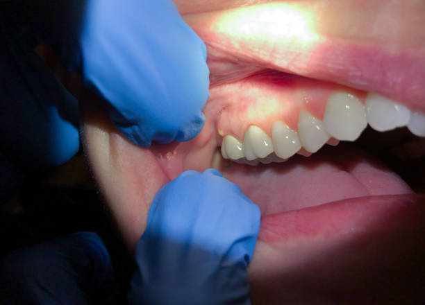 Best Emergency Dental Care for Broken or Chipped Teeth in Marlin, TX